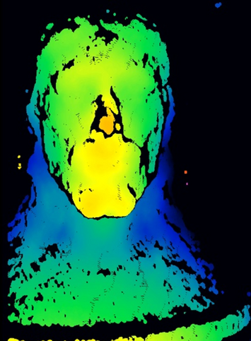 Conventional Stereo image